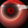 Laser Eye Technology